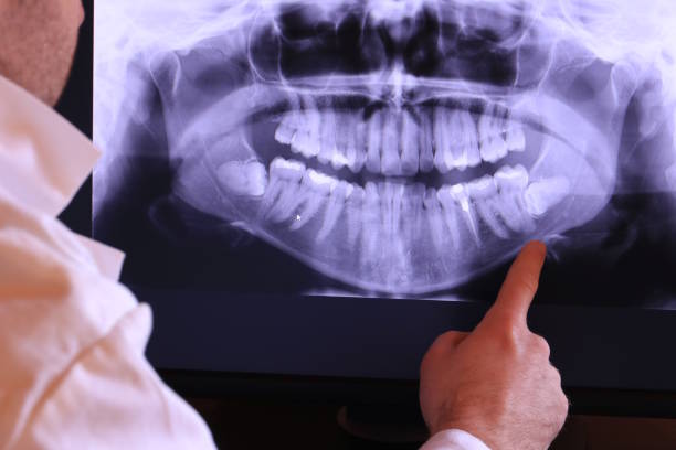 Best Emergency Broken Tooth Repair in Anchor Point, AK