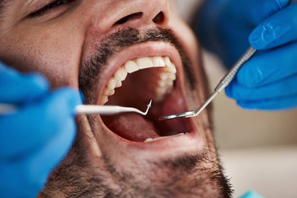 Best Emergency Tooth Extraction in Anchor Point, AK